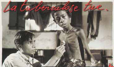 tuberculose